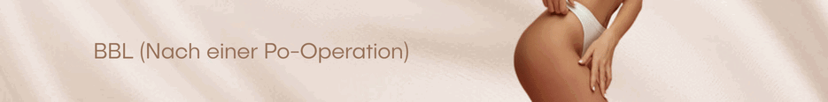 BBL (Nach einer Po-Operation)