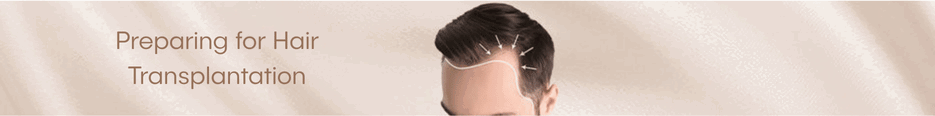 Preparing for Hair Transplantation