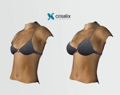 Preparation for Surgery