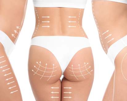 Butt Aesthetics (BBL)