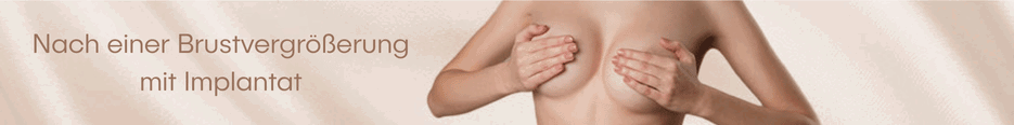 Nach einer Brustvergrößerung mit Implantat