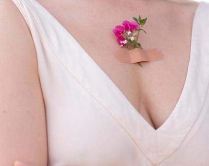 Breast Reconstruction After Cancer